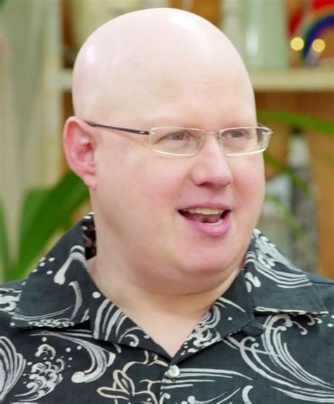 Bake Off's Matt Lucas lost his hair when he was six after  .
